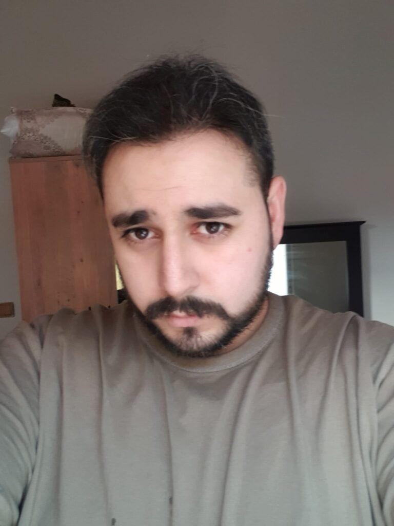 Saç Ekimi sonrası