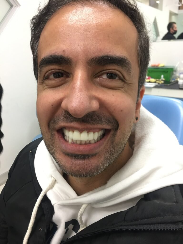 Diş Estetiği sonrası