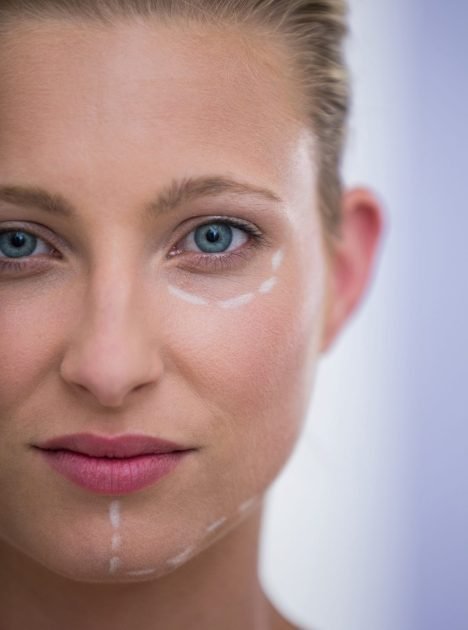 woman-with-marks-drawn-botox-procedure-min